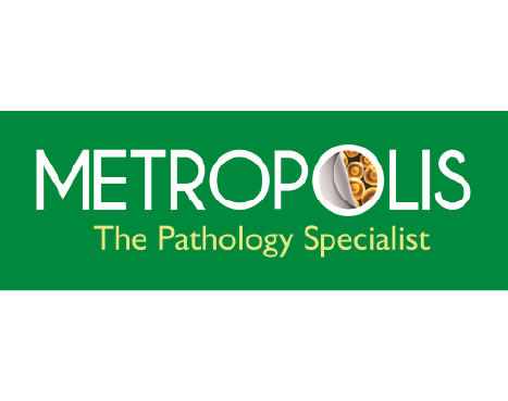 Metropolis